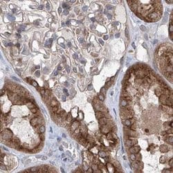 Invitrogen KLC4 Polyclonal Antibody 100 &mu;L; Unconjugated:Antibodies,