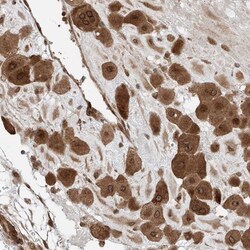 Invitrogen CEP162 Polyclonal Antibody 100 &mu;L; Unconjugated:Antibodies,