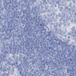 Invitrogen FRS3 Polyclonal Antibody 100 &mu;L | Buy Online | Invitrogen&trade; | Fisher Scientific