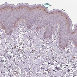 Invitrogen Hopx Polyclonal Antibody 100 &mu;L; Unconjugated:Antibodies,