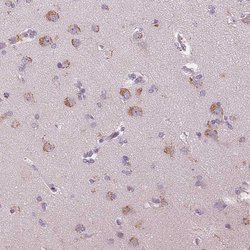 Invitrogen Hopx Polyclonal Antibody 100 &mu;L; Unconjugated:Antibodies,