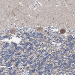 Invitrogen DST Polyclonal Antibody 100 &mu;L; Unconjugated:Antibodies,