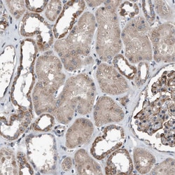 Invitrogen DST Polyclonal Antibody 100 &mu;L; Unconjugated:Antibodies,