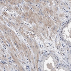Invitrogen DST Polyclonal Antibody 100 &mu;L; Unconjugated:Antibodies,