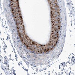 Invitrogen AGPS Polyclonal Antibody 100 &mu;L; Unconjugated:Antibodies,