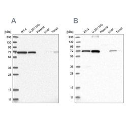 Invitrogen AGPS Polyclonal Antibody 100 &mu;L; Unconjugated:Antibodies,
