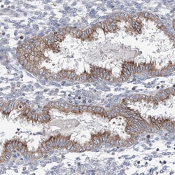Invitrogen AGPS Polyclonal Antibody 100 μL; Unconjugated:Antibodies,