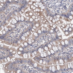 Invitrogen AGPS Polyclonal Antibody 100 μL; Unconjugated:Antibodies,
