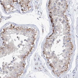 Invitrogen AGPS Polyclonal Antibody 100 μL; Unconjugated:Antibodies,
