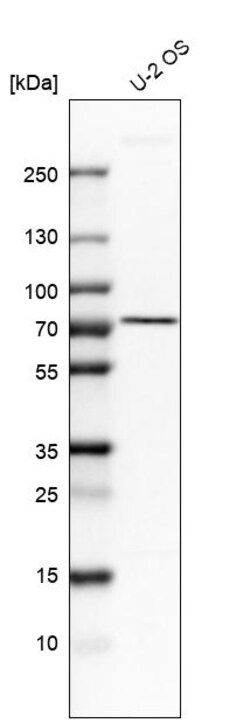 Invitrogen AGPS Polyclonal Antibody 100 &mu;L | Buy Online | Invitrogen&trade; | Fisher Scientific