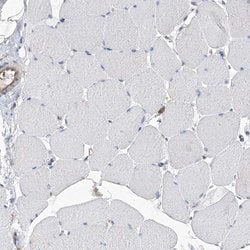Invitrogen C6orf115 Polyclonal Antibody 100 μL; Unconjugated:Antibodies,