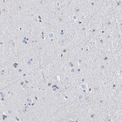 Invitrogen PSMB10 Polyclonal Antibody 100 &mu;L; Unconjugated:Antibodies,