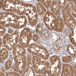 Invitrogen MTO1 Polyclonal Antibody 100 &mu;L | Buy Online | Invitrogen&trade; | Fisher Scientific