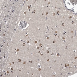 Invitrogen C1orf50 Polyclonal Antibody 100 &mu;L; Unconjugated:Antibodies,