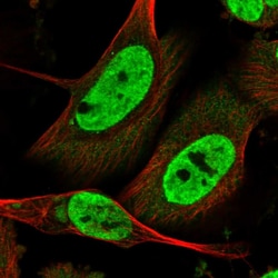 Invitrogen LIN9 Polyclonal Antibody 100 &mu;L; Unconjugated:Antibodies,