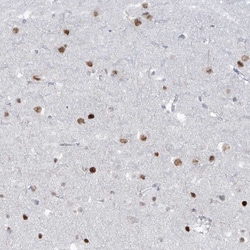Invitrogen LIN9 Polyclonal Antibody 100 &mu;L; Unconjugated:Antibodies,