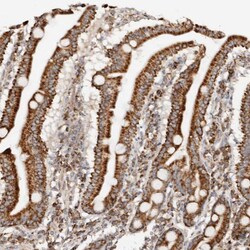 Invitrogen PCBP3 Polyclonal Antibody 100 &mu;L; Unconjugated:Antibodies,