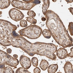 Invitrogen DACT2 Polyclonal Antibody 100 &mu;L; Unconjugated:Antibodies,