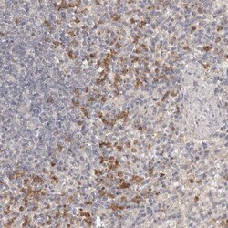 Invitrogen USP49 Polyclonal Antibody 100 &mu;L; Unconjugated:Antibodies,