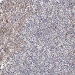 Invitrogen DIP2C Polyclonal Antibody 100 &mu;L; Unconjugated:Antibodies,