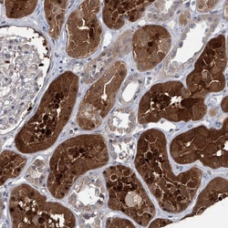 Invitrogen AKNAD1 Polyclonal Antibody 100 &mu;L; Unconjugated:Antibodies,