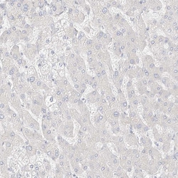 Invitrogen ITPKB Polyclonal Antibody 100 &mu;L | Buy Online | Invitrogen&trade; | Fisher Scientific
