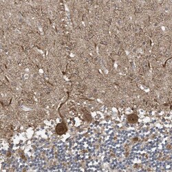 Invitrogen NCOA7 Polyclonal Antibody 100 &mu;L; Unconjugated:Antibodies,