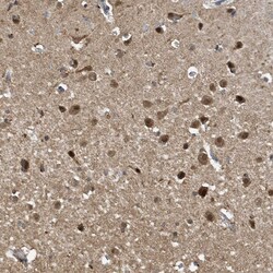 Invitrogen NCOA7 Polyclonal Antibody 100 &mu;L; Unconjugated:Antibodies,