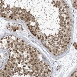 Invitrogen NCOA7 Polyclonal Antibody 100 &mu;L; Unconjugated:Antibodies,
