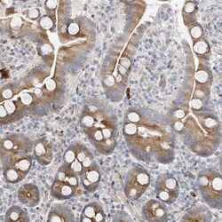 Invitrogen TYSND1 Polyclonal Antibody 100 &mu;L; Unconjugated:Antibodies,