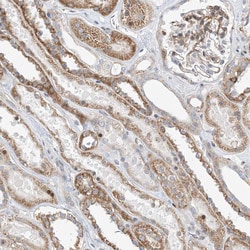 Invitrogen TYSND1 Polyclonal Antibody 100 &mu;L; Unconjugated:Antibodies,