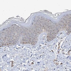 Invitrogen TYSND1 Polyclonal Antibody 100 &mu;L; Unconjugated:Antibodies,
