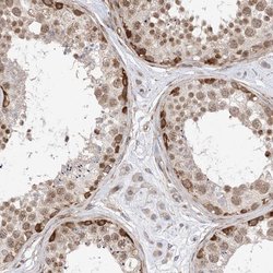 Invitrogen TYSND1 Polyclonal Antibody 100 &mu;L; Unconjugated:Antibodies,