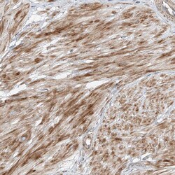 Invitrogen PUM2 Polyclonal Antibody 100 &mu;L; Unconjugated:Antibodies,