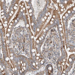 Invitrogen PUM2 Polyclonal Antibody 100 &mu;L; Unconjugated:Antibodies,