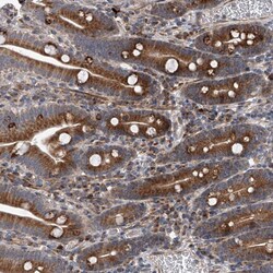 Invitrogen™ SAPAP2 Polyclonal Antibody