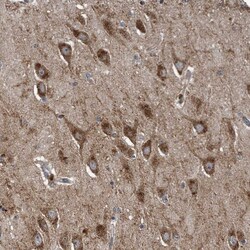 Invitrogen LYRM4 Polyclonal Antibody 100 &mu;L; Unconjugated:Antibodies,