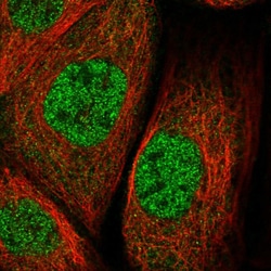 Invitrogen ZNF30 Polyclonal Antibody 100 &mu;L; Unconjugated:Antibodies,