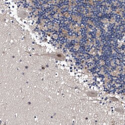 Invitrogen ZNF30 Polyclonal Antibody 100 &mu;L; Unconjugated:Antibodies,