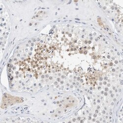 Invitrogen ARHGAP28 Polyclonal Antibody 100 &mu;L; Unconjugated:Antibodies,