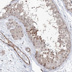 Invitrogen ZBTB48 Polyclonal Antibody 100 &mu;L; Unconjugated:Antibodies,