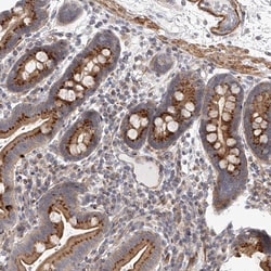Invitrogen SLC37A1 Polyclonal Antibody 100 &mu;L; Unconjugated:Antibodies,
