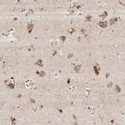 Invitrogen MRPS33 Polyclonal Antibody 100 &mu;L; Unconjugated:Antibodies,