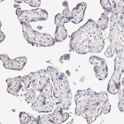 Invitrogen MRPS33 Polyclonal Antibody 100 &mu;L; Unconjugated:Antibodies,