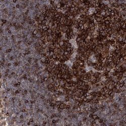 Invitrogen FAM167A Polyclonal Antibody 100 &mu;L | Buy Online | Invitrogen&trade; | Fisher Scientific