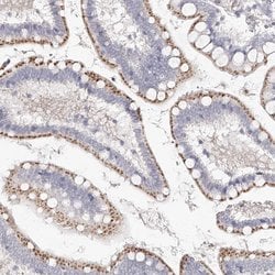 Invitrogen SLC35D3 Polyclonal Antibody 100 &mu;L; Unconjugated:Antibodies,