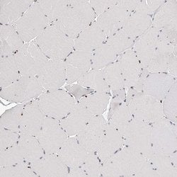 Invitrogen SLC35D3 Polyclonal Antibody 100 &mu;L; Unconjugated:Antibodies,