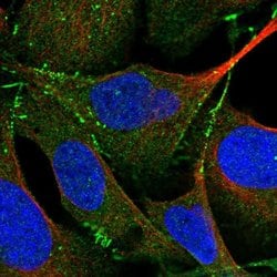 Invitrogen PARD3 Polyclonal Antibody 100 &mu;L; Unconjugated:Antibodies,