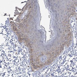 Invitrogen PARD3 Polyclonal Antibody 100 &mu;L; Unconjugated:Antibodies,