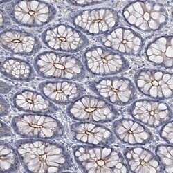 Invitrogen PARD3 Polyclonal Antibody 100 &mu;L; Unconjugated:Antibodies,